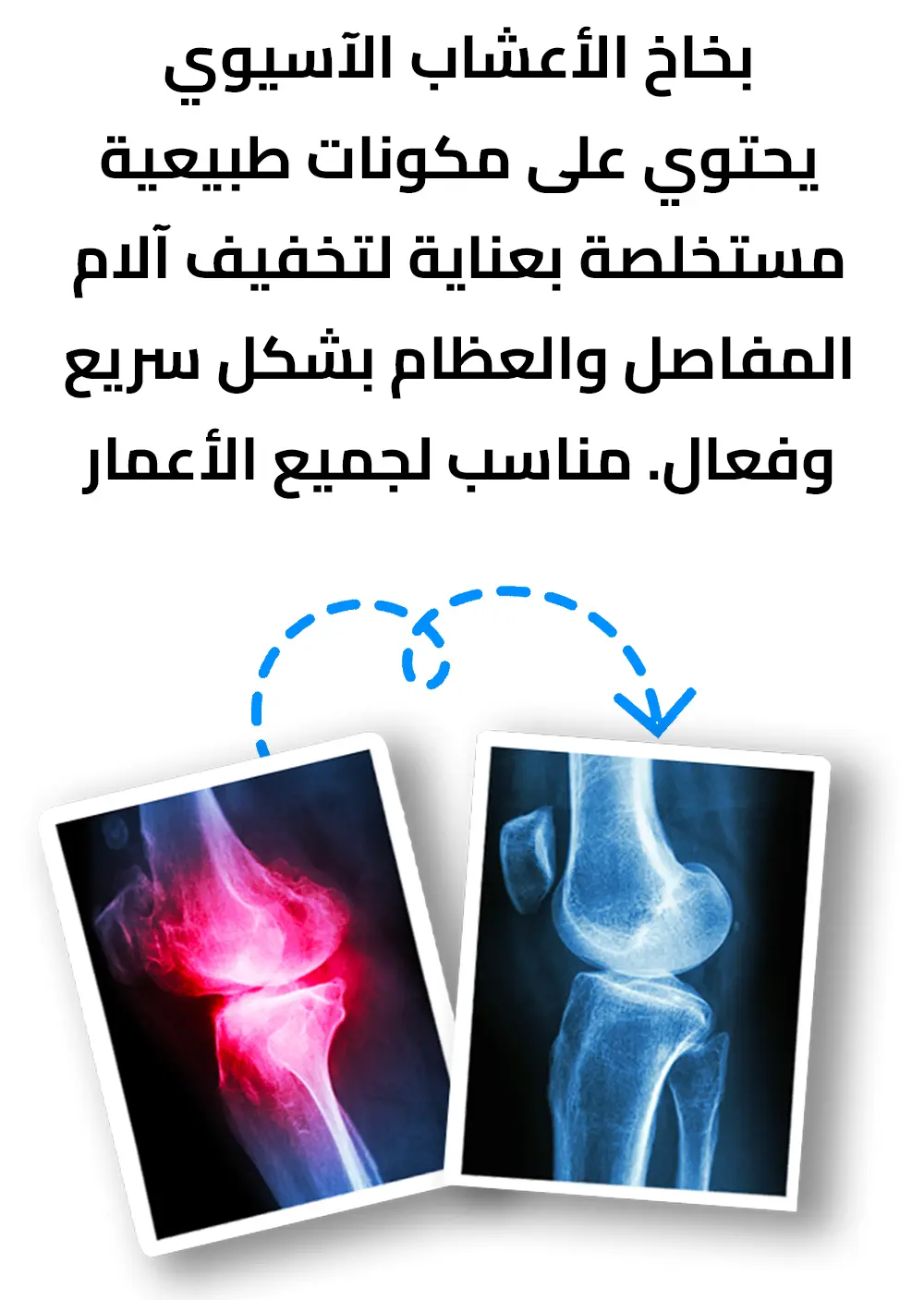بخاخ الصيني لتخلص من الام الركبة والكتف والمفاصل 32