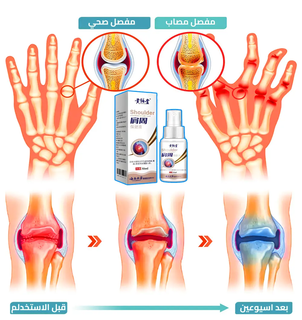 بخاخ الصيني لتخلص من الام الركبة والكتف والمفاصل 36