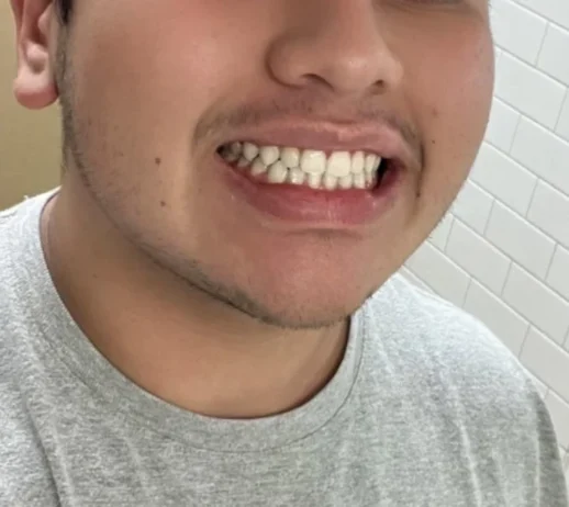 هاي سمايل معجون تبييض الاسنان الصفراء V34 13