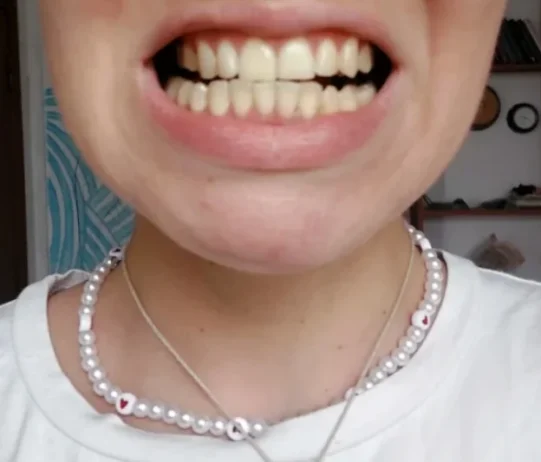 هاي سمايل معجون تبييض الاسنان الصفراء V34 10