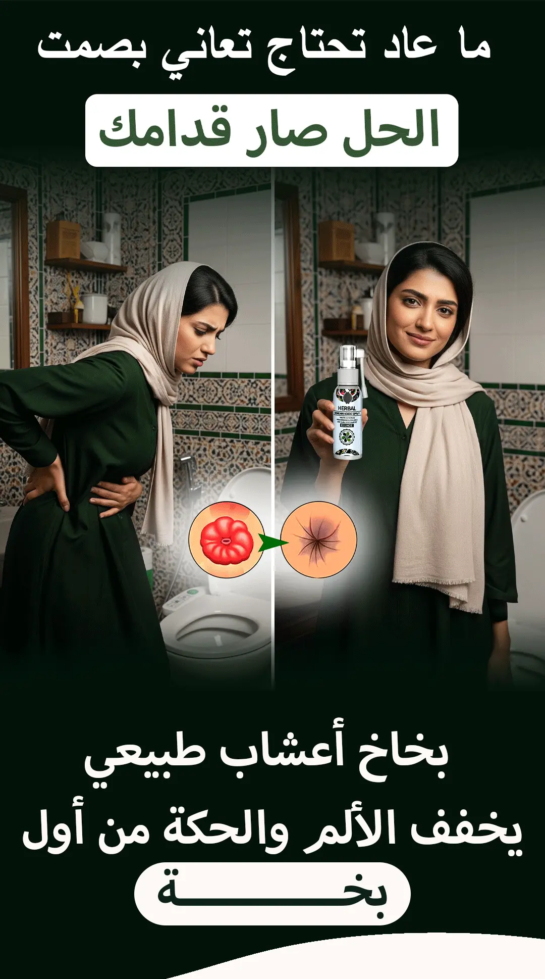 بخاخ البواسير الطبيعي للبواسير الداخلية والخارجية 6